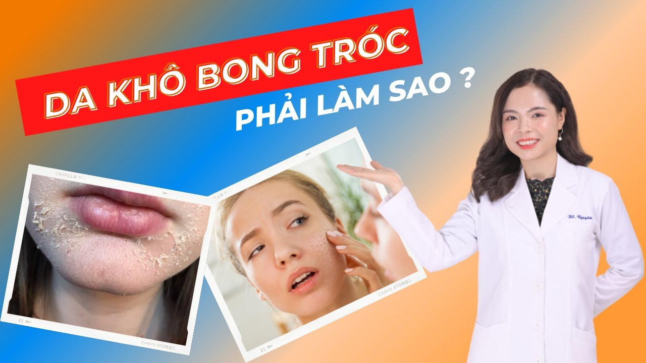 Da khô bong tróc phải làm sao? 5 Mẹo khắc phục da khô hiệu quả | Bác sĩ Nguyên
