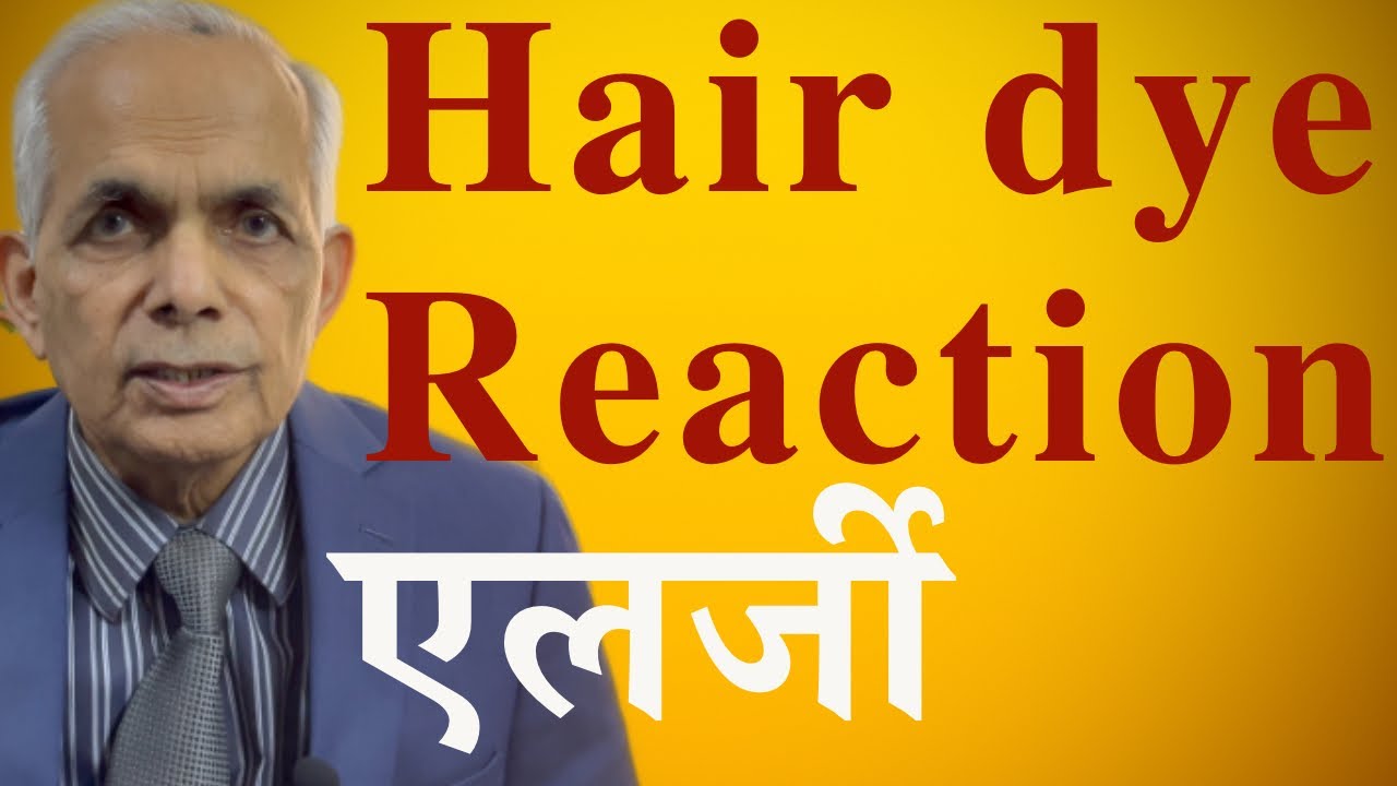 Hair Dye allergy, reaction; बालों की डाई से एलर्जी रिएक्शन