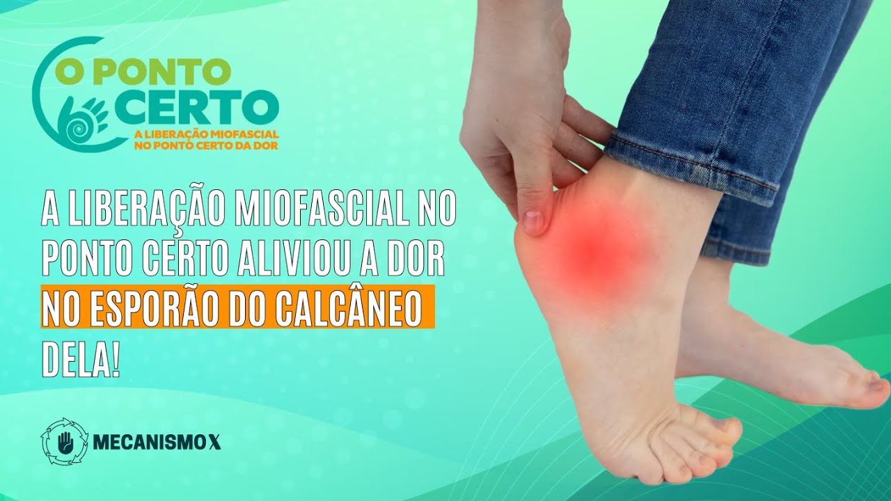 A LIBERAÇÃO MIOFASCIAL NO PONTO CERTO ALIVIOU A DOR NO ESPORÃO DE CALCÂNEO DELA!