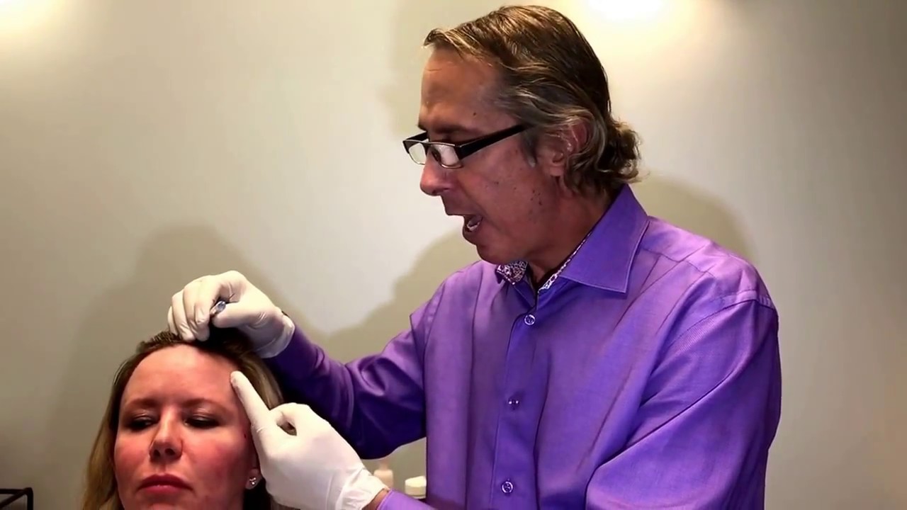Restylane Refyne to Temples and Brow - First YouTube Refyne Video Dr Weiner
