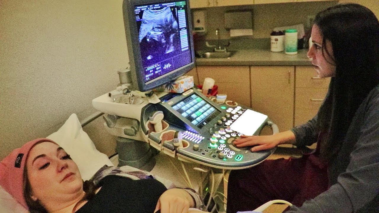 Scanning the BABY!!!!