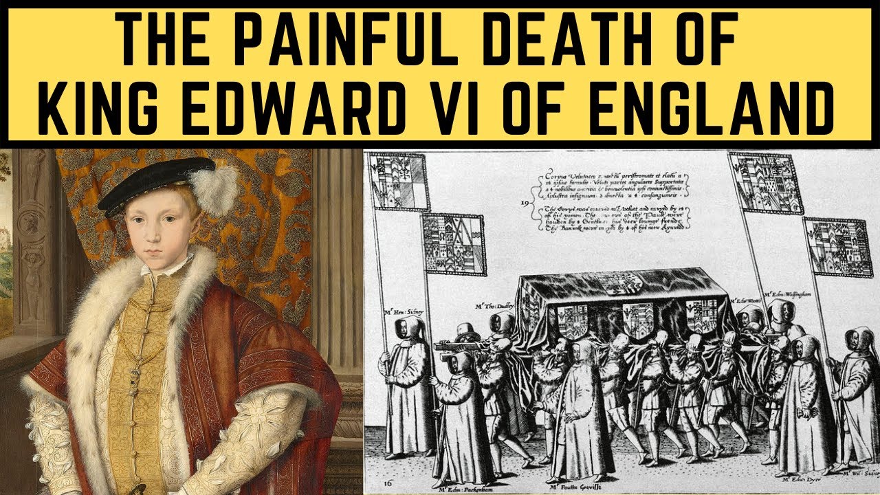 The PAINFUL Death Of King Edward VI Of England - The Boy Tudor King