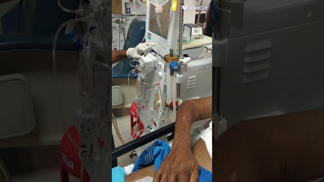 procedimiento de conexi&oacute;n de cat&eacute;ter en hemodi&aacute;lisis #hemodialysis #tiktok #video #viral #shorts