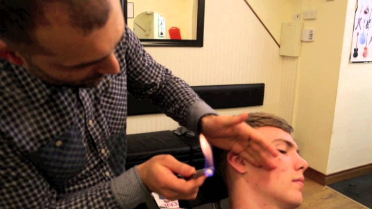 Hair Singeing By The Turkish Barbers Lucan Dublin Ireland