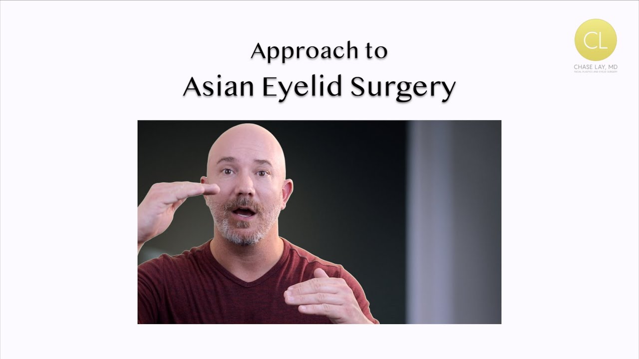 Approach to Asian Eyelid Surgery: Dr. Chase Lay explains the differences types