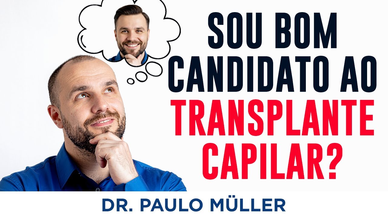 Como Saber se Sou Bom Candidato ao Transplante Capilar?