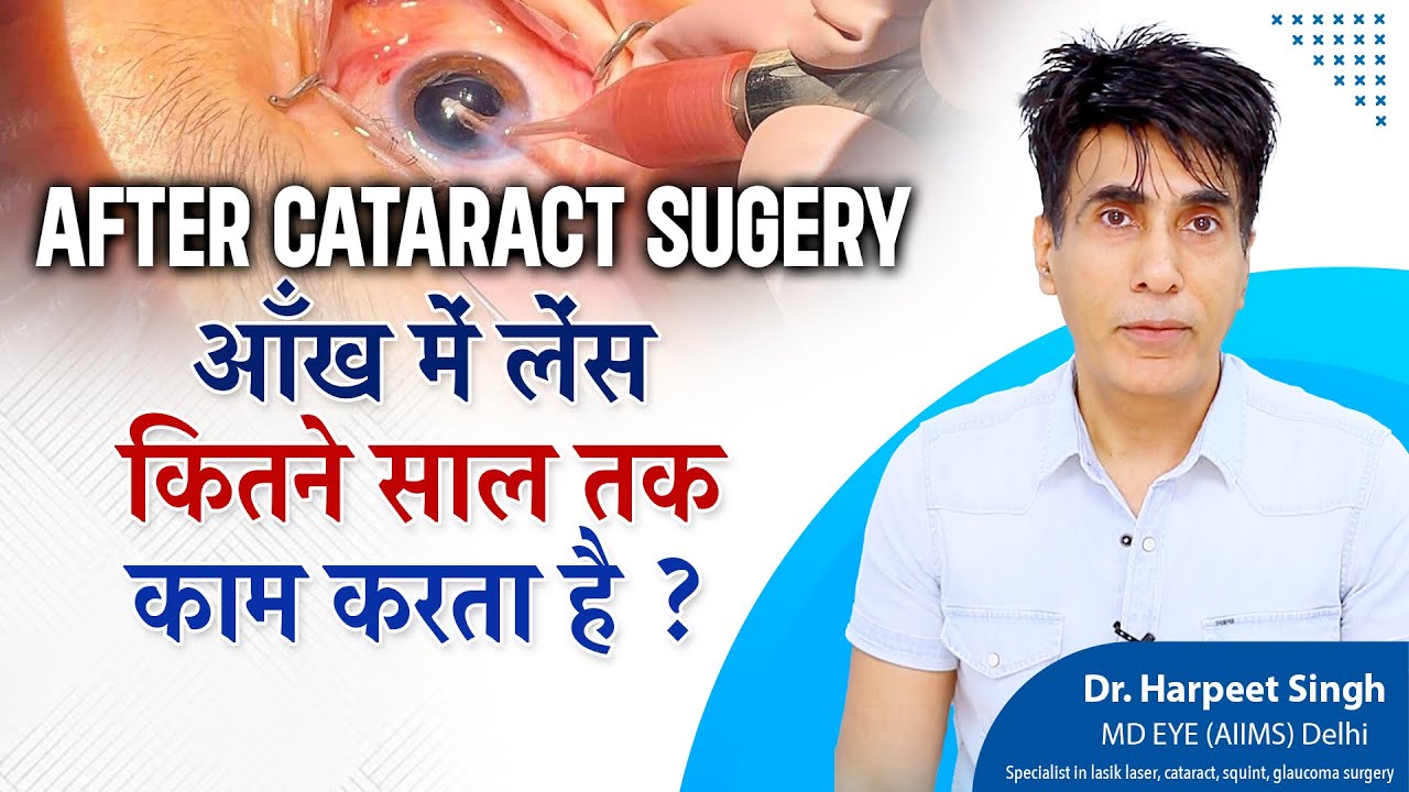 After Cataract Surgery आँख में लेंस कितने साल तक काम करता है ? | Life of Cataract surgery lens