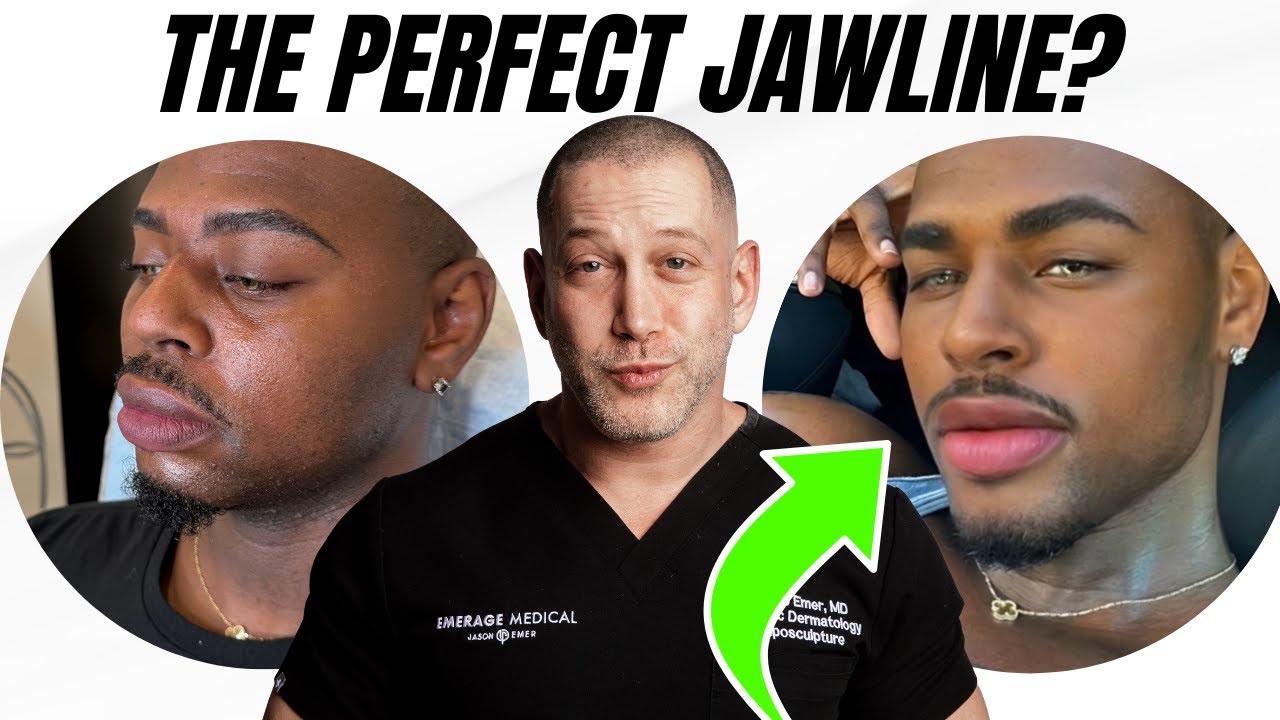 Male Model Facial Sculpting in Minutes | Dr. Jason Emer