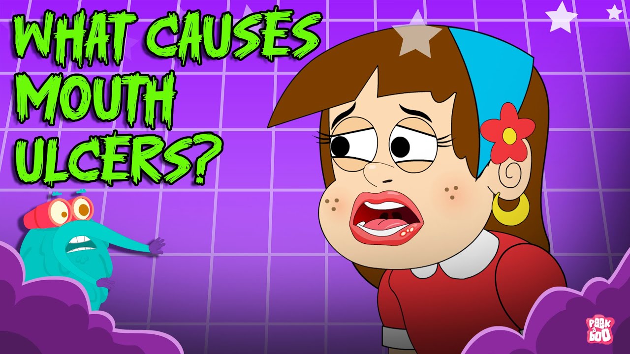 What Causes Mouth Ulcers? | Painful Mouth Sores Explained | Oral Health Facts | Dr. Binocs Show
