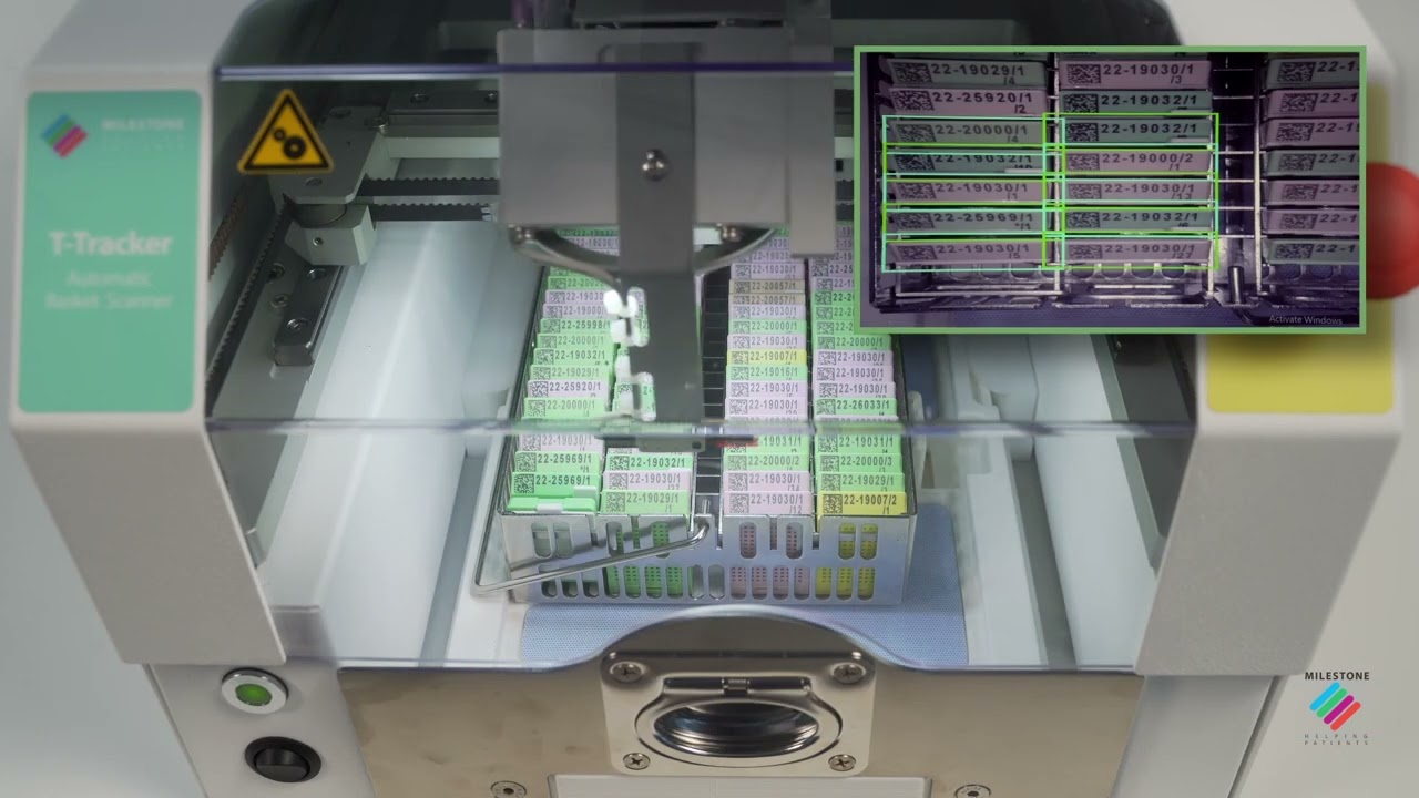 T-Tracker: How It Works