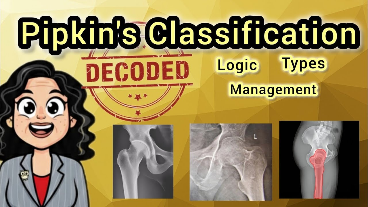 Pipkin's Classification Decoded . Logic Types & Management 