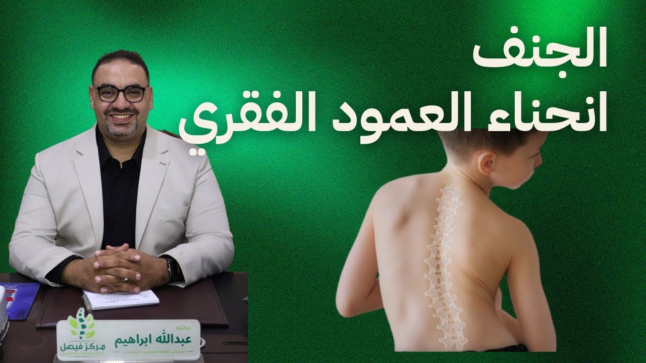 انحناء العمود الفقري و الجنف العلاج و السبب