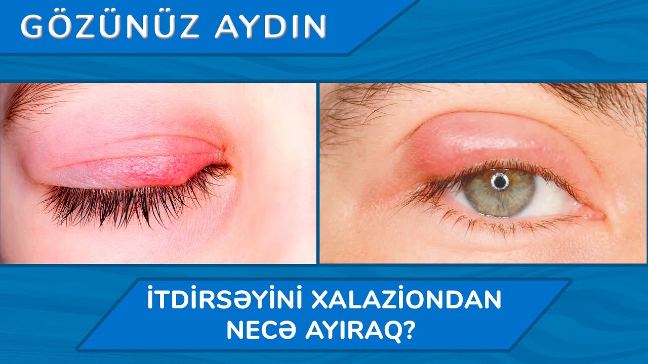 Gözünüz aydın - İtdirsəyini xalaziondan necə ayıraq?