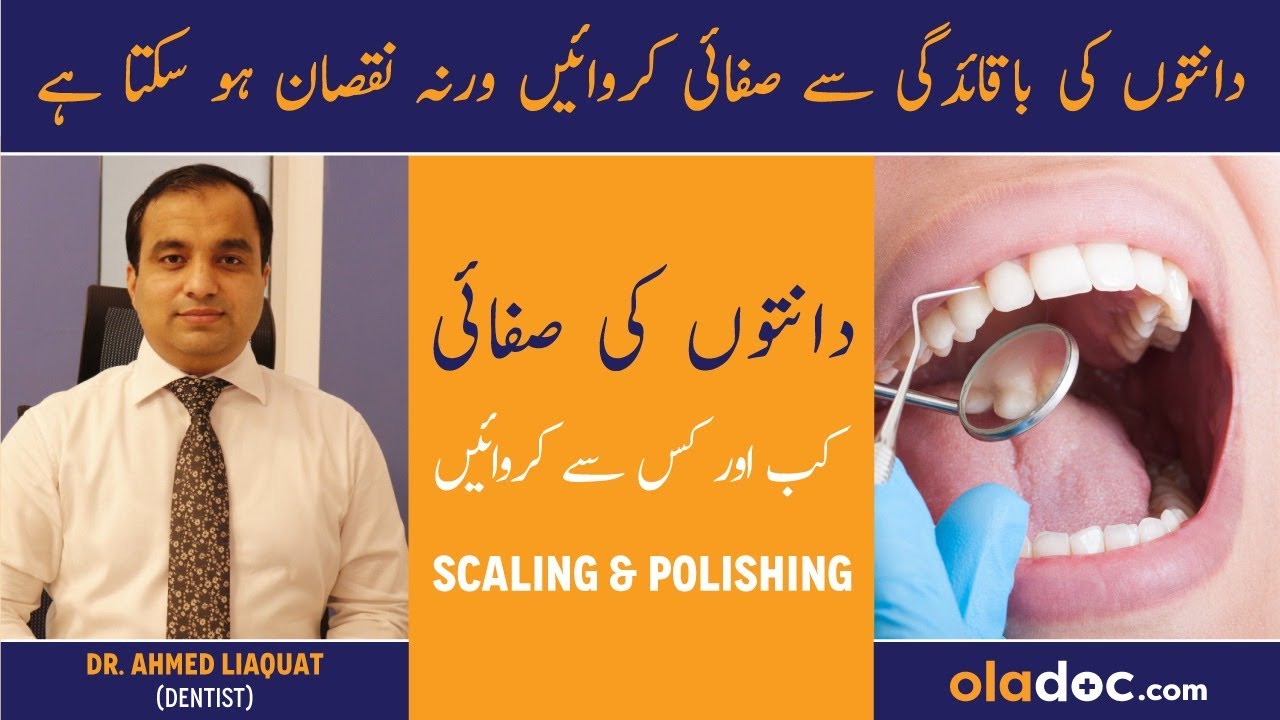 Scaling And Polishing - Dental Cleaning - Danto Ki Scaling Aur Safai - Plaque Removal From Teeth