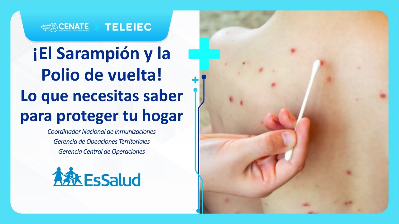 ¡El Sarampión y la Polio han vuelto! Lo que necesitas saber para proteger a tu hogar.