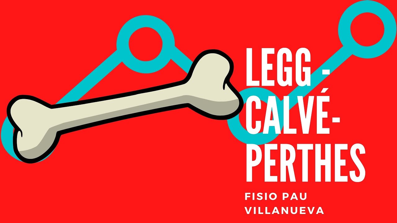 ENFERMEDAD DE LEGG-CALVÉ-PERTHES.