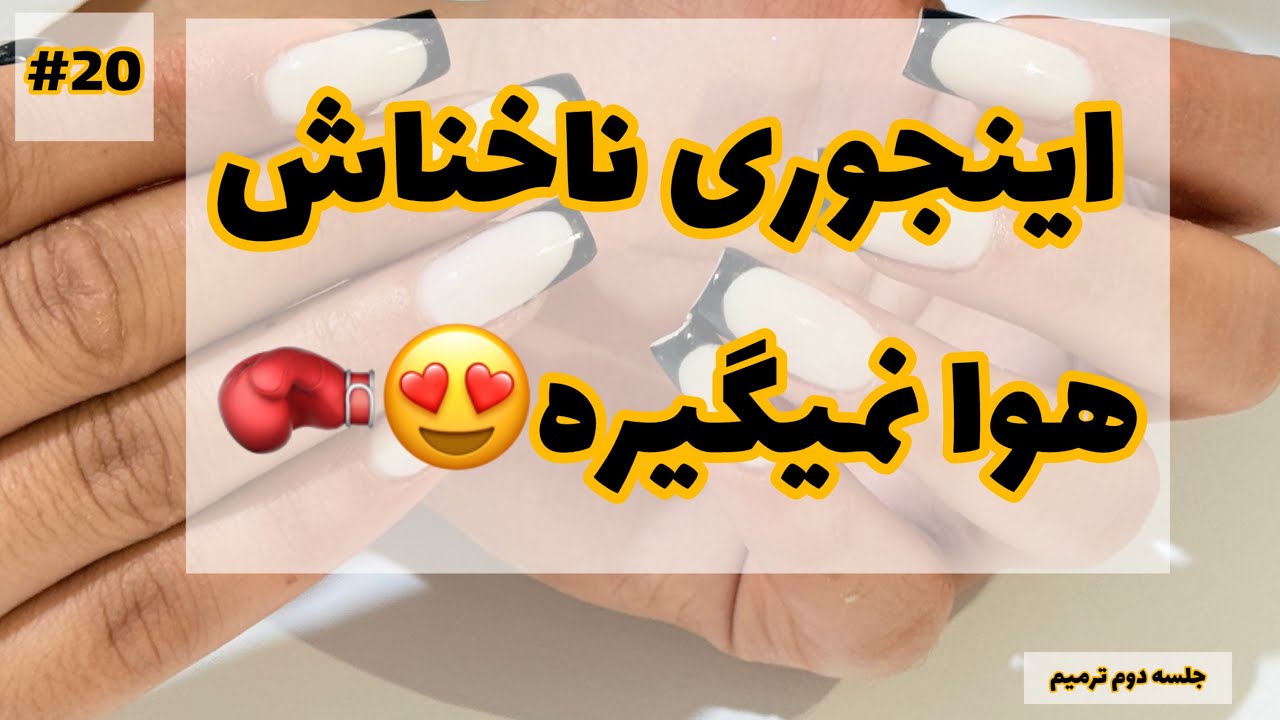 ترمیم سریع و اصولی با پلی ژل😍
