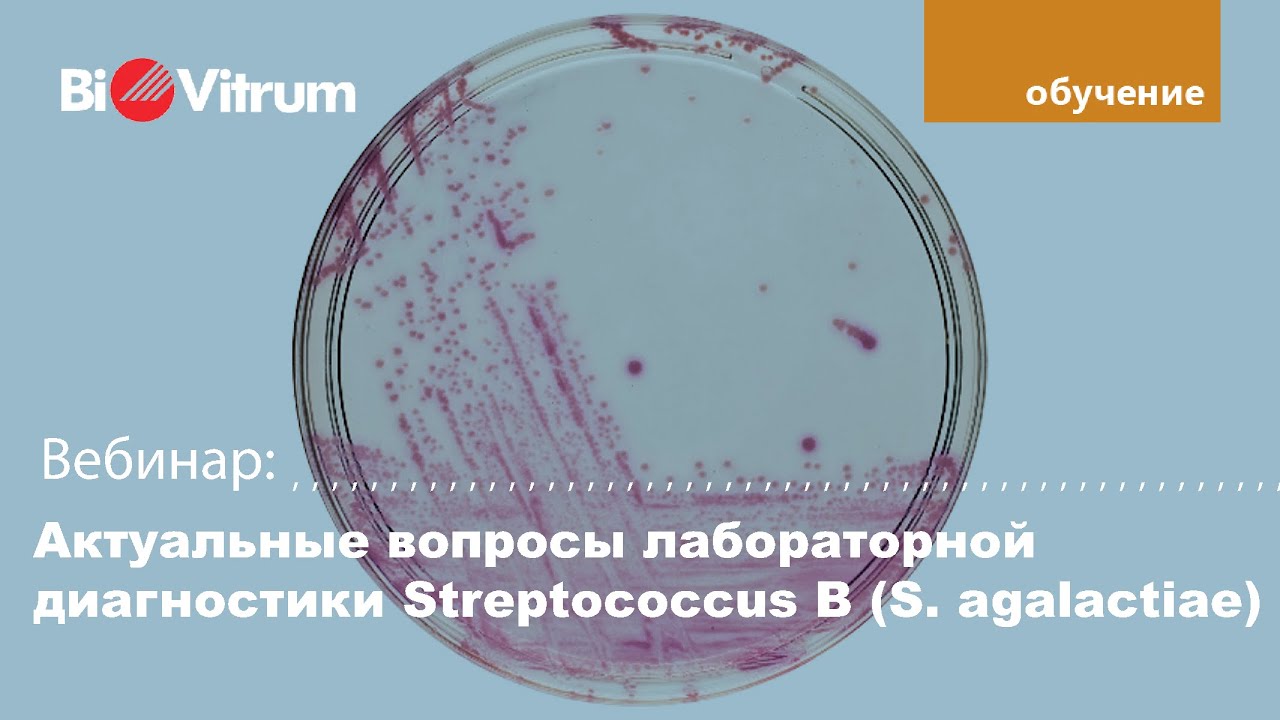 Актуальные вопросы лабораторной диагностики Streptococcus B S  agalactiae