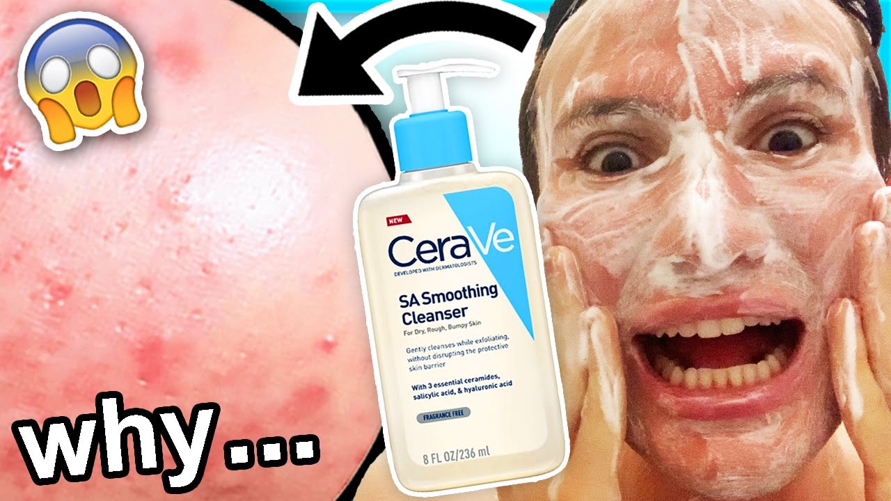 I tried CeraVe SA Cleanser for ONE WEEK!! (I was shocked honey... in tears almost)