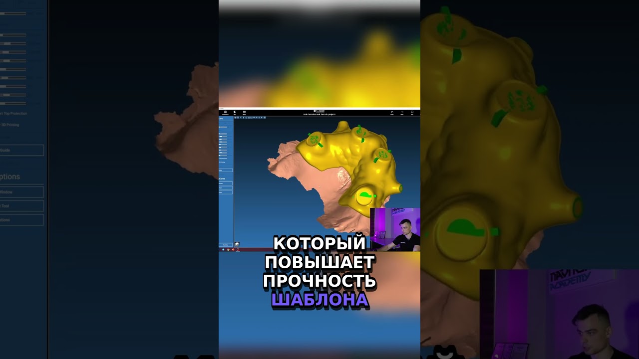 Как укрепить шаблон  секреты прочности! 💪