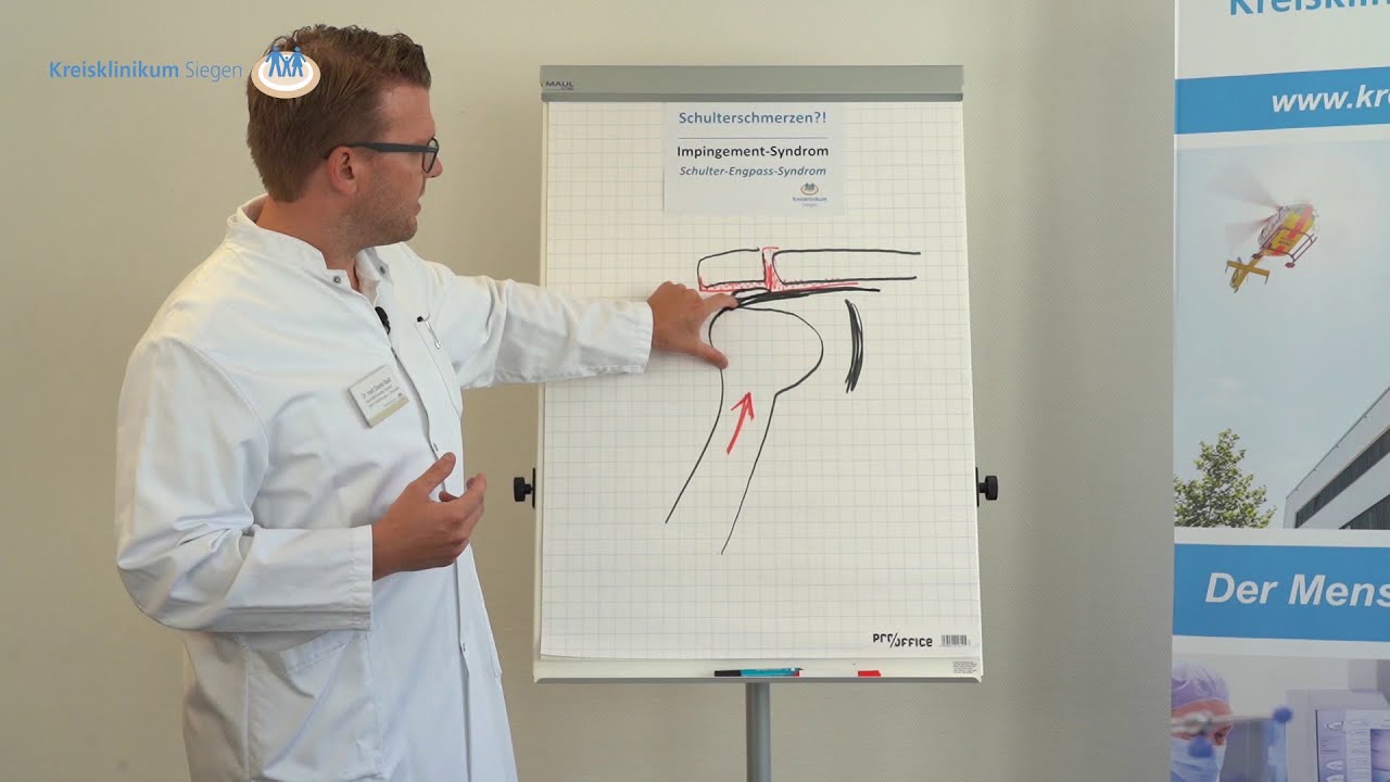 Schulterschmerzen?! Das Impingement-Syndrom als häufigste Ursache