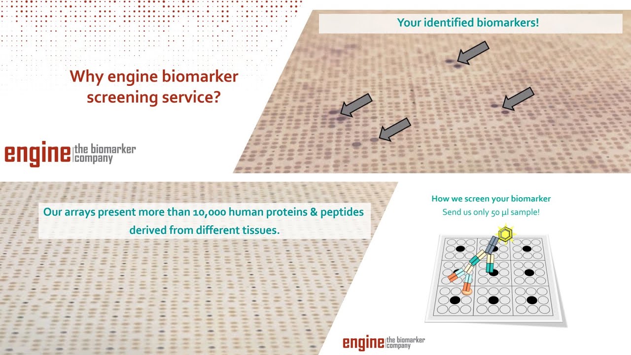 engine biomarker screening service with protein arrays