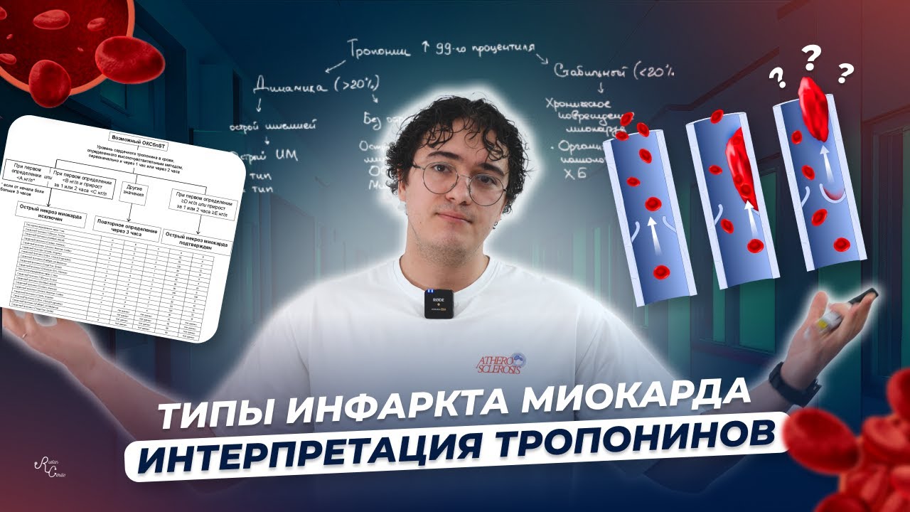 Типы инфаркта миокарда. Интерпретация тропонина