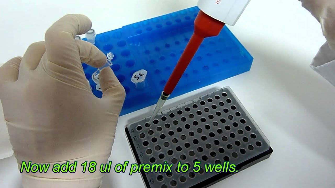 Ready to use realtime PCR kit for Chlamydia trachomatis (manual) Genekam Biotech