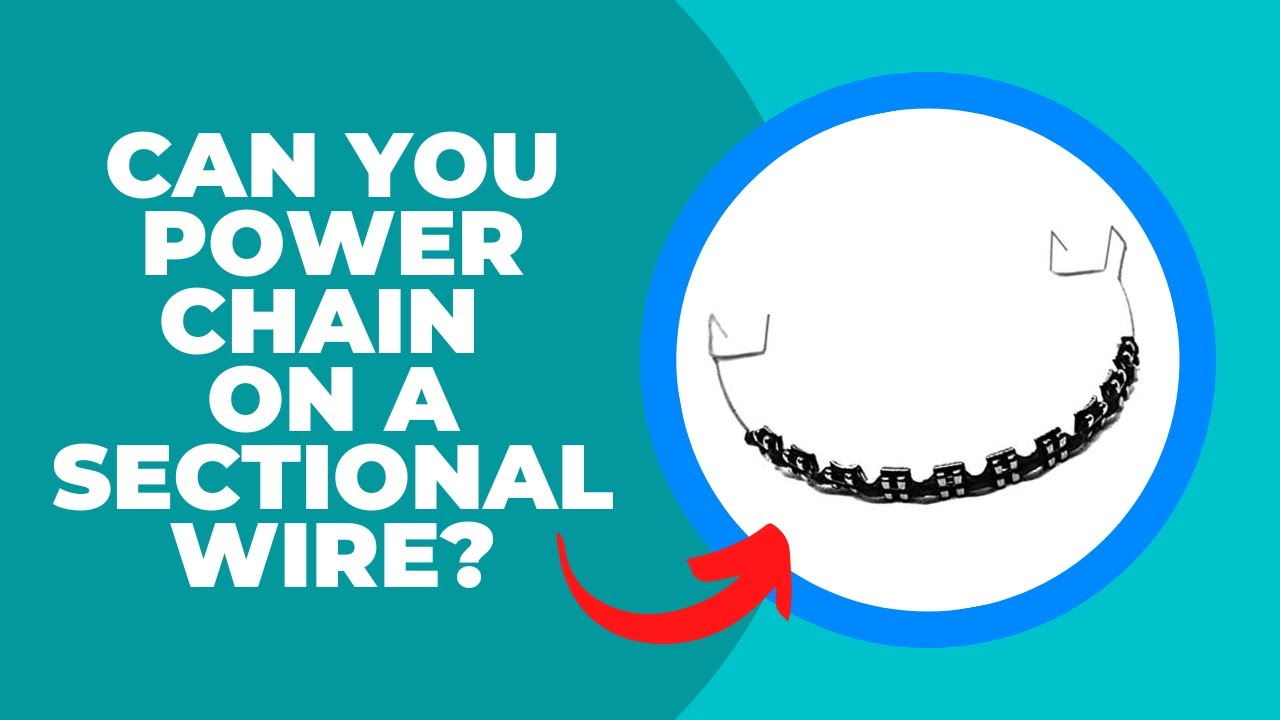 Can you Power Chain on a Sectional Wire?