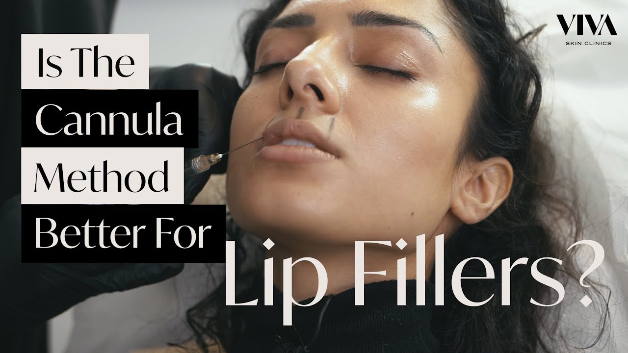 The Cannula Method For Lip Fillers? 💋 (2021) Natural Lip Filler