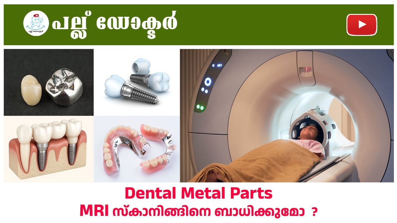 Do Dental Metal Parts Affect MRI Scanning? | Dental Metal Parts MRI സ്കാനിങ്ങിനെ ബാധിക്കുമോ?