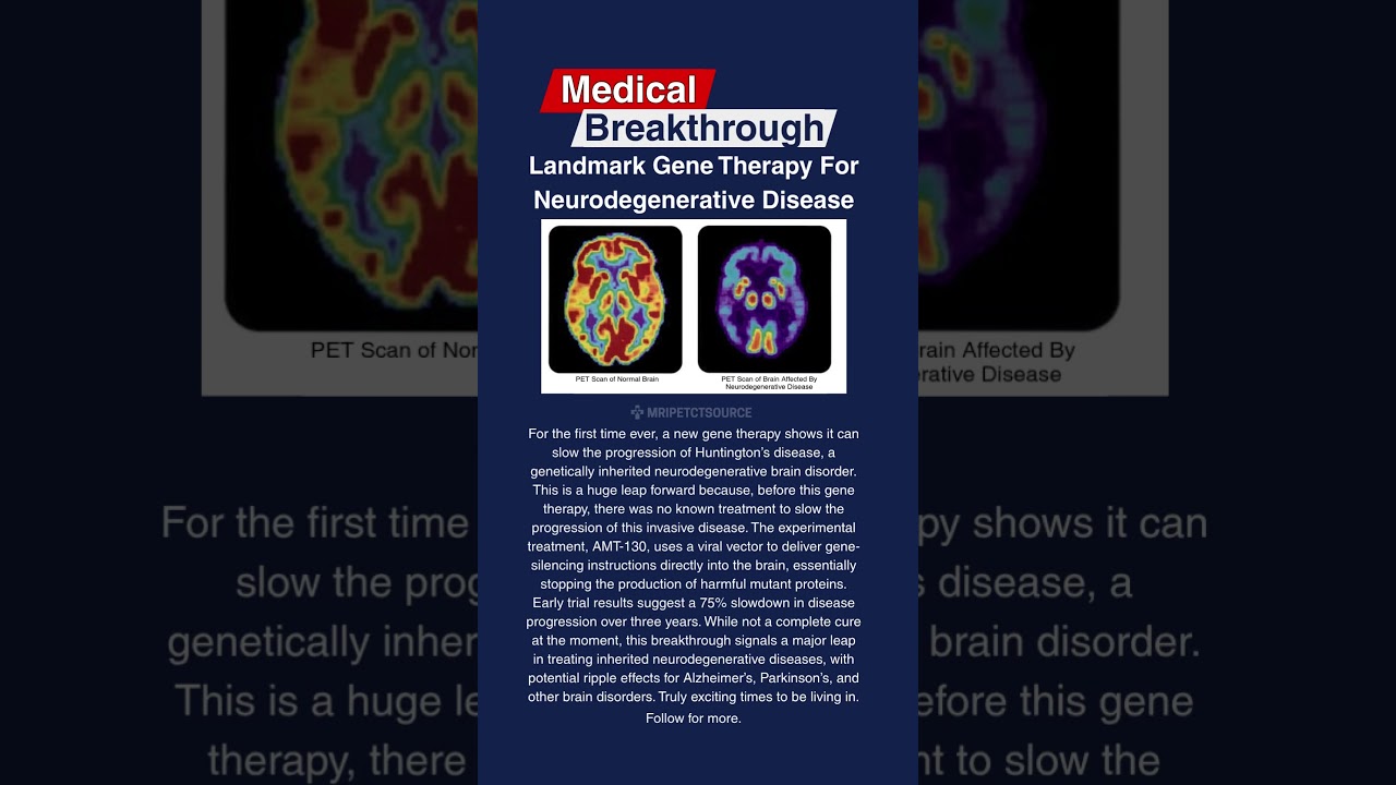 Could This Be the End of Certain Brain Diseases?#medical #science #hope #news