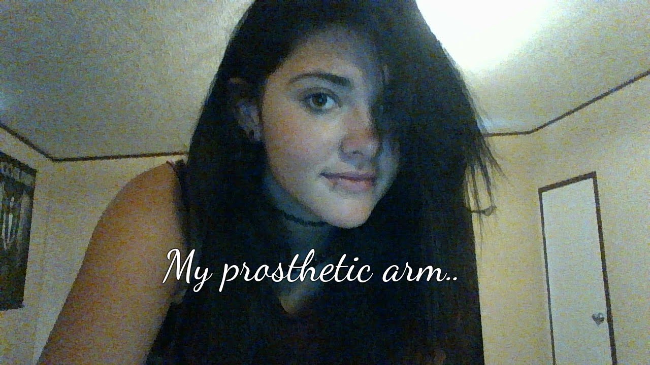 My Prosthetic Arm