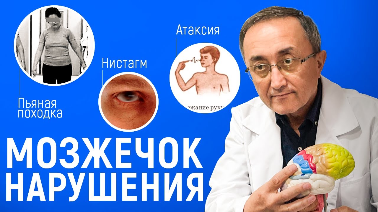 Мозжечок и его Нарушения | Лекция по Неврологии 2024