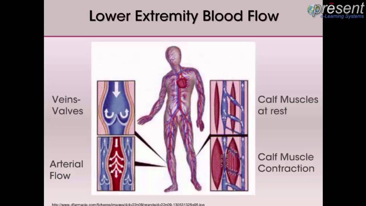Venous Leg Ulcers Pathophysiology and Assessment