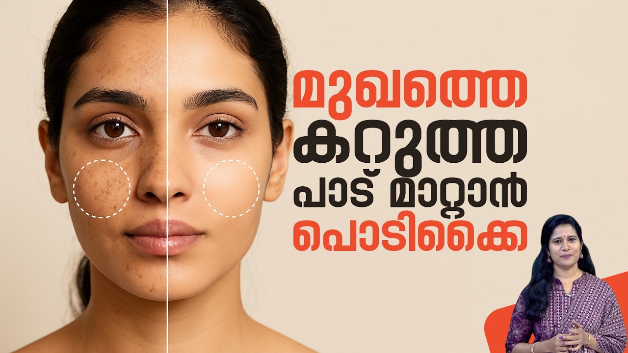 കരിമംഗല്യം മാറ്റാം വീട്ടിൽ തന്നെ | Karimangalyam removal