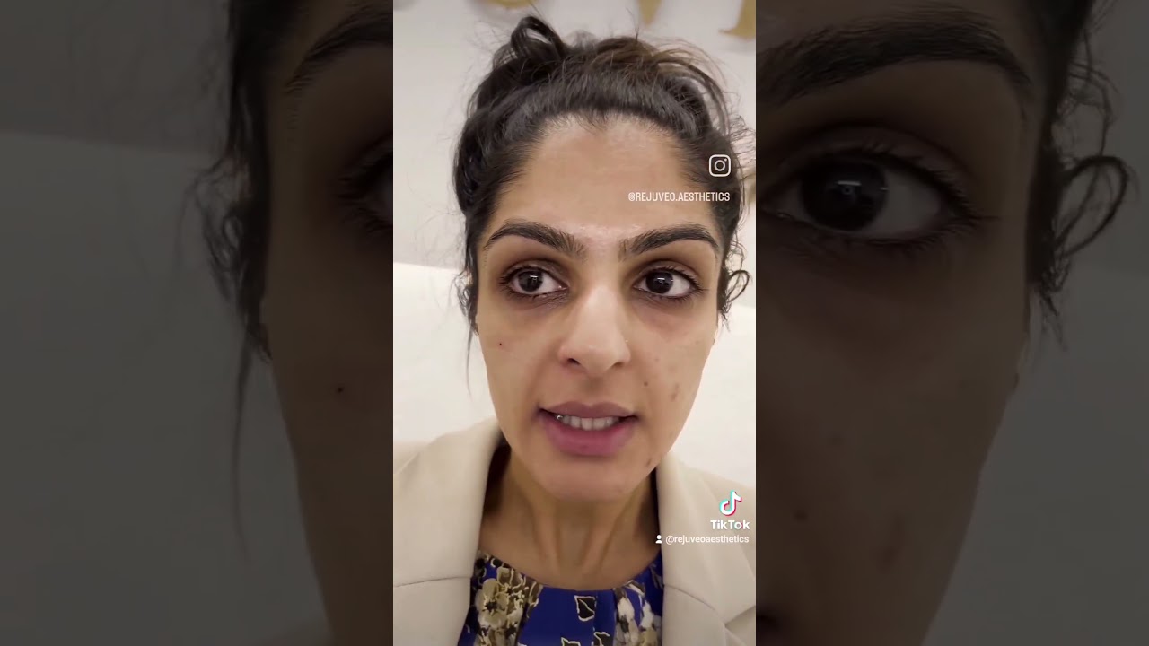Does Under Eye Filler Make A Difference?!