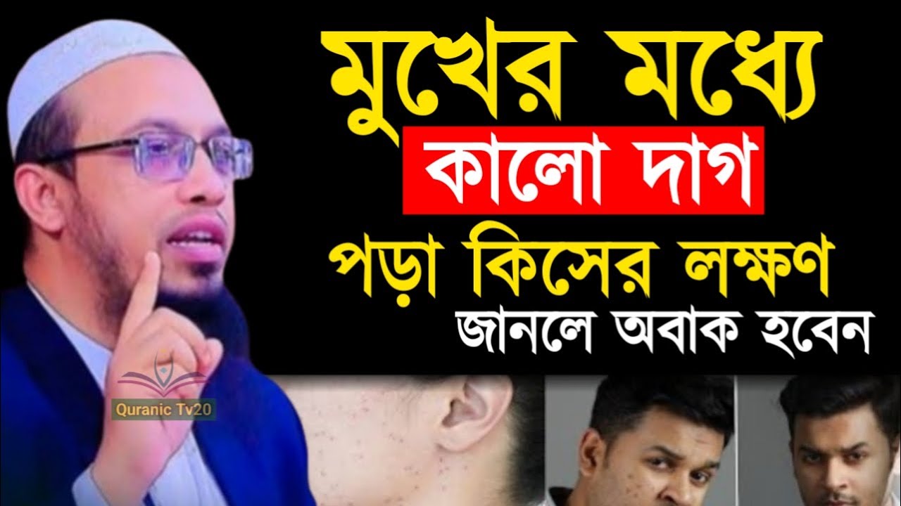 মুখের মধ্যে কালো দাগ পড়া কিসের লক্ষণ জানলে অবাক হবেন  ! আহমাদুল্লাহ
