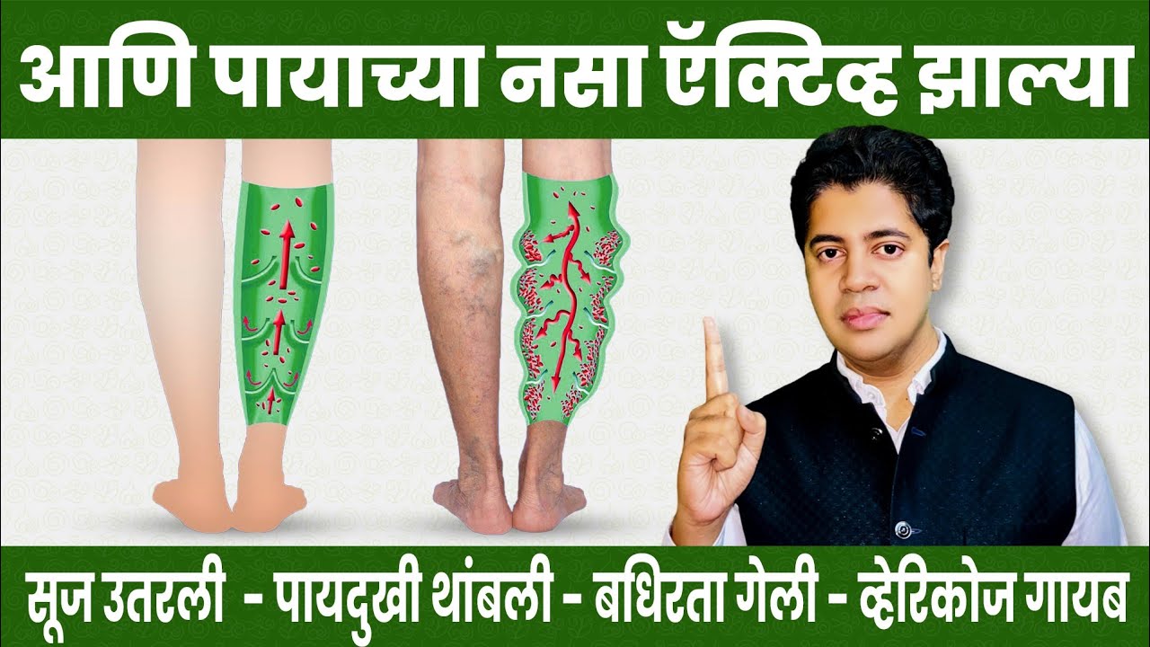 पायाच्या नसा ऍक्टिव्ह होतील - रक्त प्रवाह सुरळीत होईल - पाय दुखी थांबेल