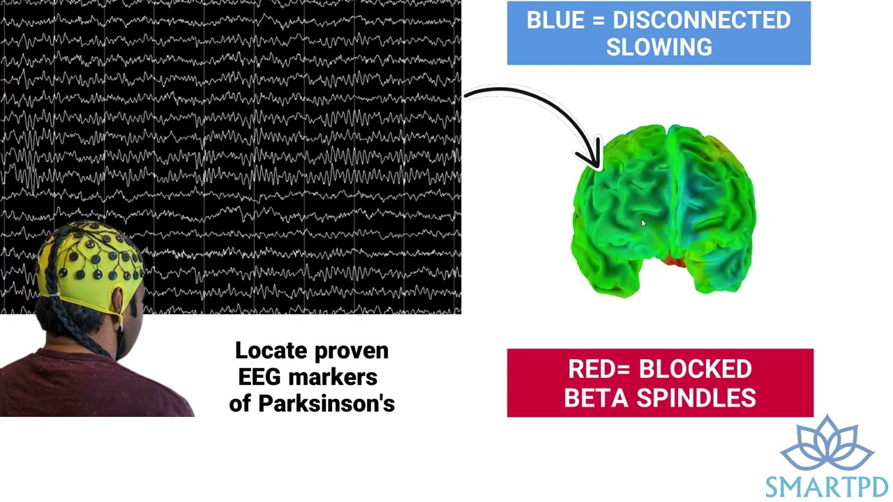 Regain Control: How to get started with Neurofeedback for Parkinson's