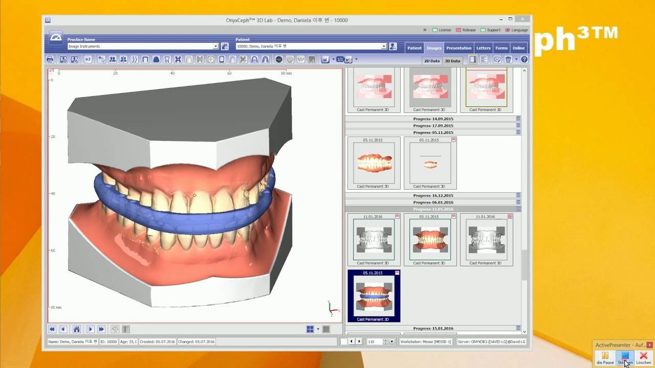 OnyxCeph³™ Module Waefer Creation 3D