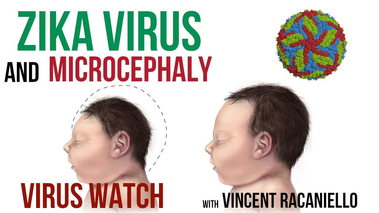 Virus Watch: Zika Virus and Microcephaly
