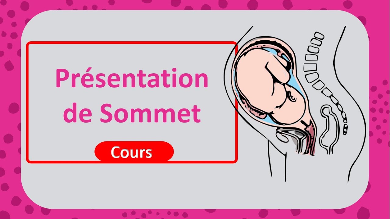 La présentation du sommet 👶Tout savoir sur l'accouchement 🤓 - Cours - Gynéco_obstétrique