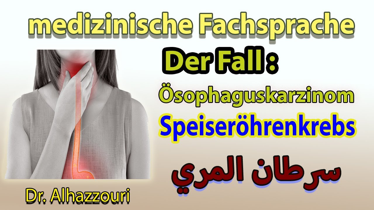 Ösophaguskarzinom . medizinosche Fachsprache FSP -  سرطان المري