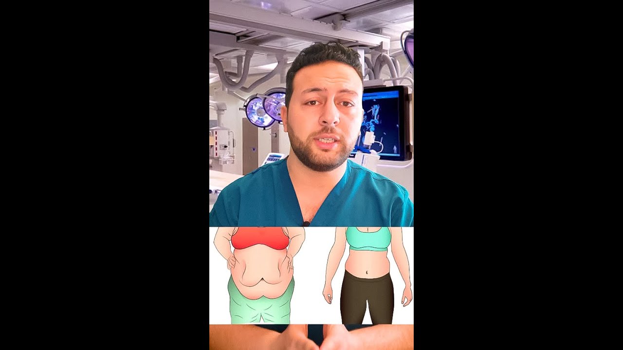 خمسه خرافات عن عمليها ازاله ترهلات البطن