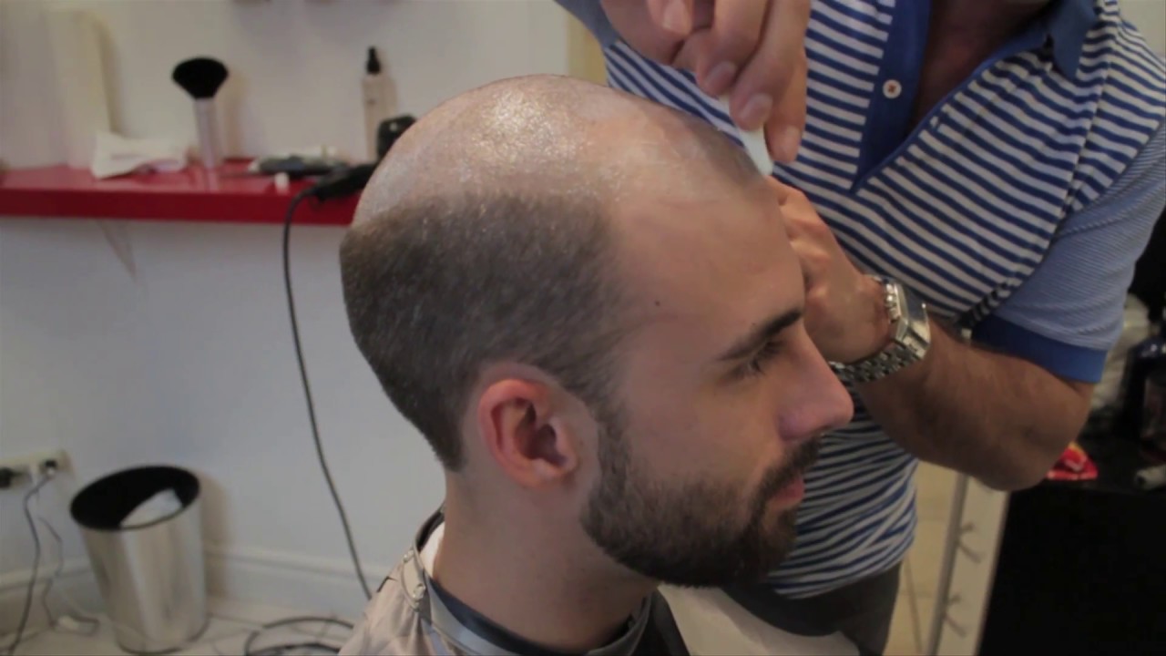 Hair Replacement for Men at The Hair Clinic Montreal featuring The Non Surgical Hair Transplant