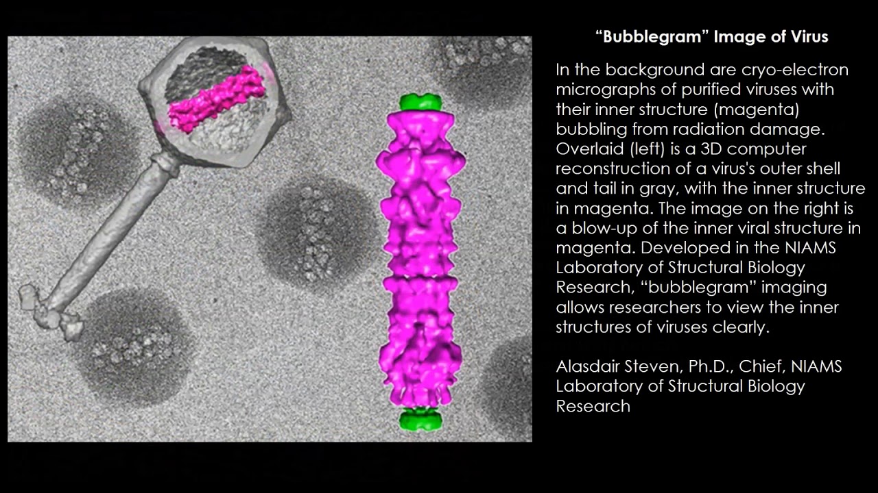 NIAMS Scientific Image Gallery