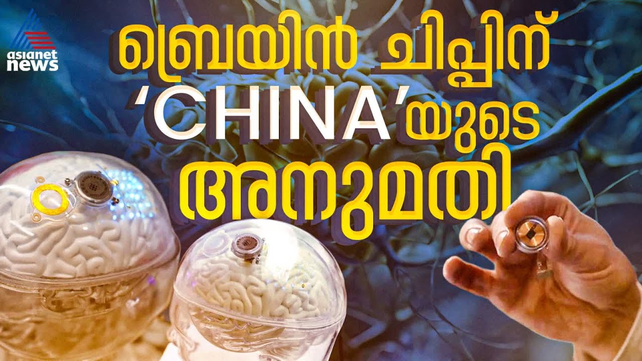 ബ്രെയിൻ ചിപ്പിന് അനുമതി നൽകി ചൈന; തീരുമാനമെടുത്ത ആദ്യ രാജ്യം