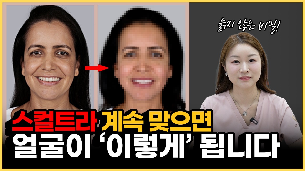 스컬트라, 계속 맞으면 얼굴이 ‘이렇게’ 변합니다. 그런데 스컬트라, 효과 없다고요? 스컬트라의 진짜 효과 보는 팁부터 원리, 부작용까지 이 한 편으로 총정리합니다!