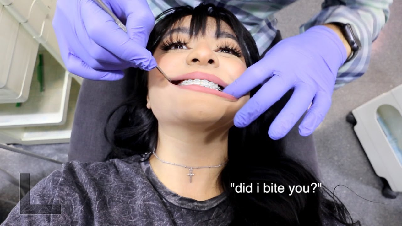 BRACES UPDATE: they are coming off next month [hopefully]